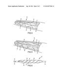 ASSISTED CUTTING BALLOON diagram and image