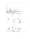 Device and Method for Treating a Chronic Total Occlusion diagram and image