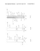 Device and Method for Treating a Chronic Total Occlusion diagram and image