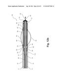 Device and Method for Treating a Chronic Total Occlusion diagram and image