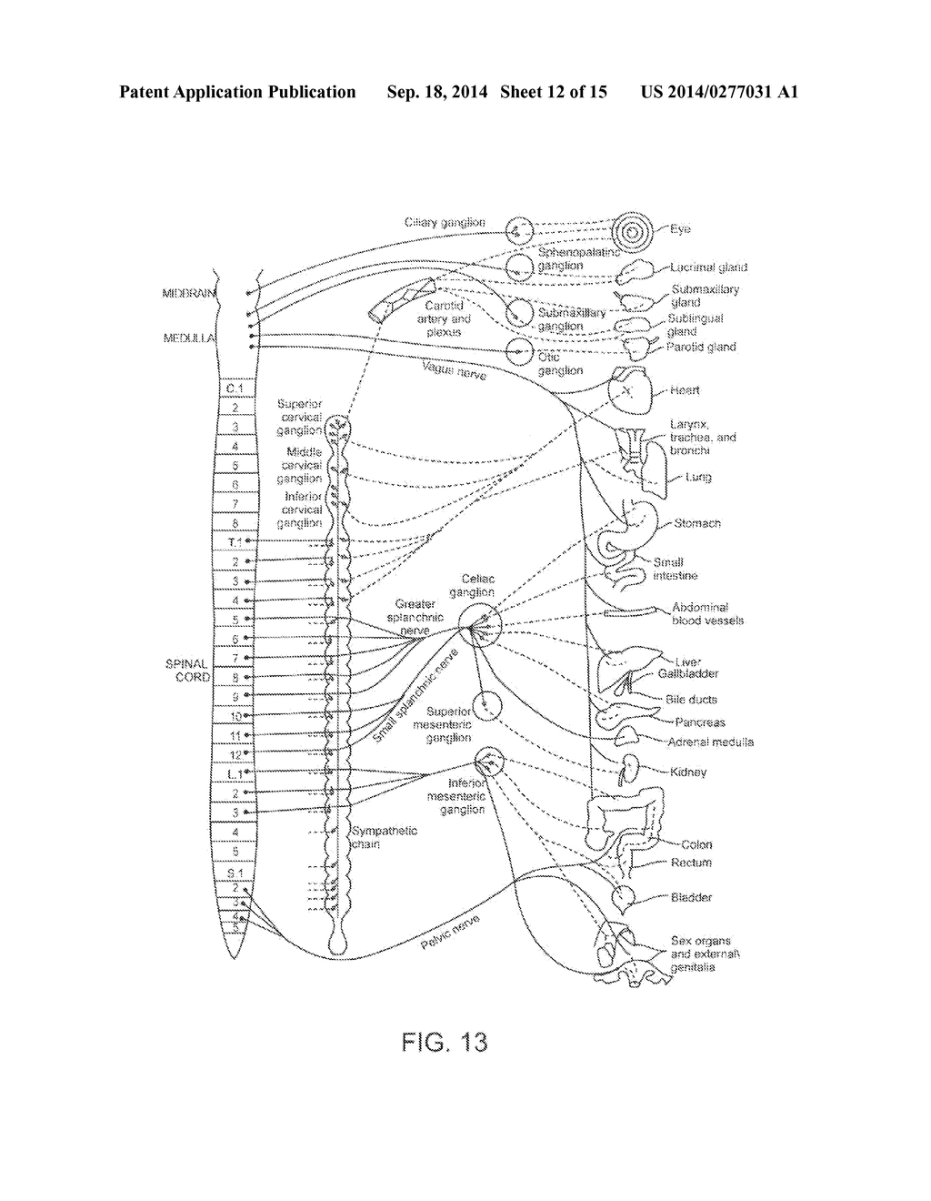 Ultrasonic Catheter for Renal Denervation - diagram, schematic, and image 13