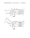 Reverse Seam Ripper Dissector diagram and image