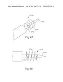 APPARATUS AND METHOD FOR TREATMENT OF ETHMOID SINUSITIS diagram and image