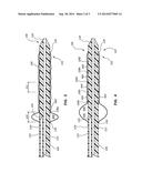 VARIABLE LENGTH BALLOON diagram and image