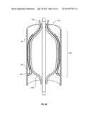 FILTER WITH DEPLOYABLE ANCHORS diagram and image