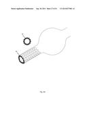 SHAPE-SET TEXTILE STRUCTURE BASED MECHANICAL THROMBECTOMY SYSTEMS diagram and image