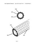 SHAPE-SET TEXTILE STRUCTURE BASED MECHANICAL THROMBECTOMY SYSTEMS diagram and image