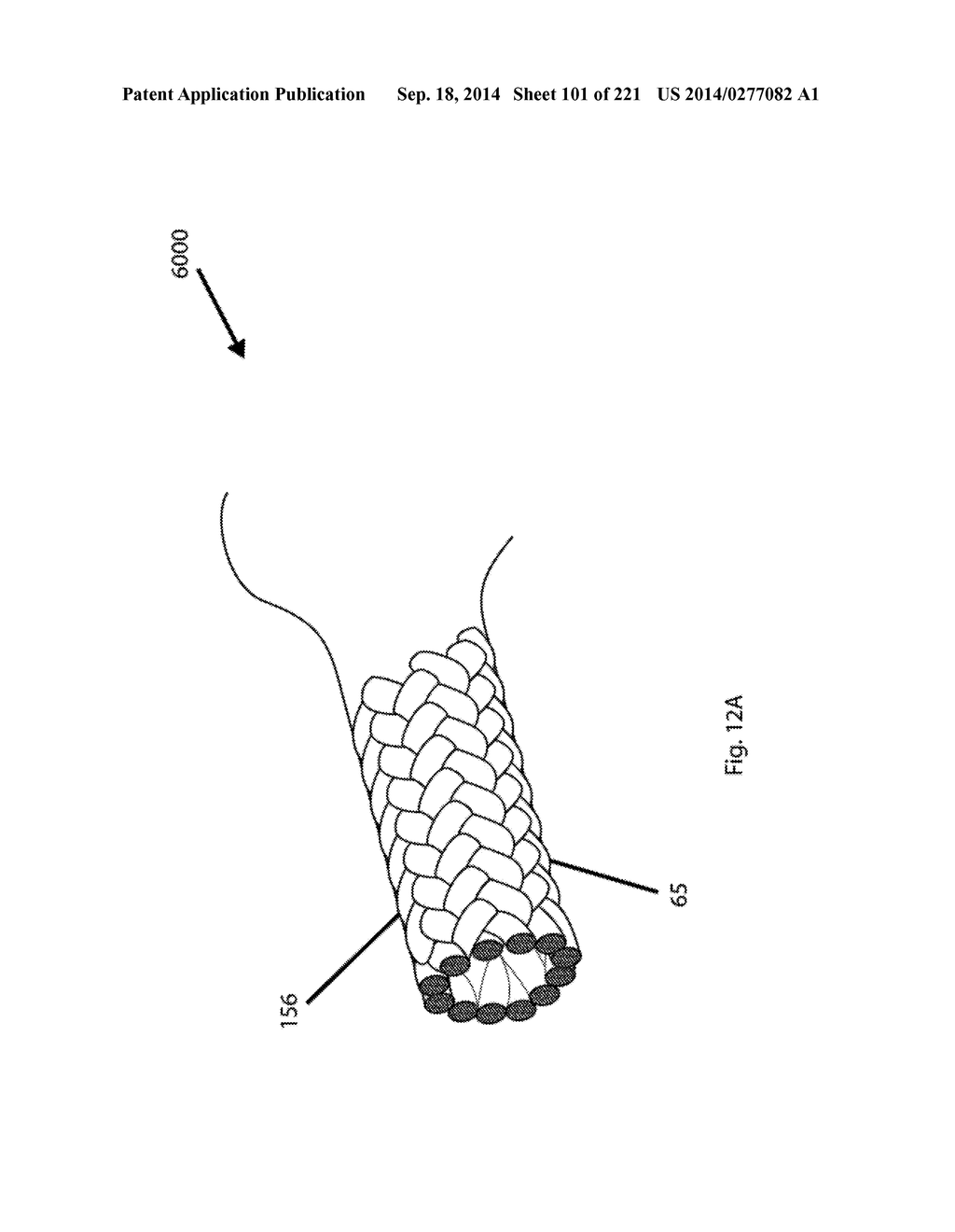 WOVEN VASCULAR DEVICE END TREATMENTS - diagram, schematic, and image 102
