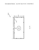 WOVEN VASCULAR DEVICE END TREATMENTS diagram and image