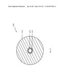 WOVEN VASCULAR DEVICE END TREATMENTS diagram and image