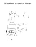 WOVEN VASCULAR DEVICE END TREATMENTS diagram and image