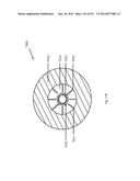 WOVEN VASCULAR DEVICE END TREATMENTS diagram and image