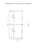 WOVEN VASCULAR DEVICE END TREATMENTS diagram and image