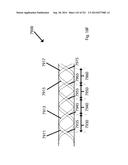 WOVEN VASCULAR DEVICE END TREATMENTS diagram and image