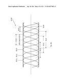 WOVEN VASCULAR DEVICE END TREATMENTS diagram and image