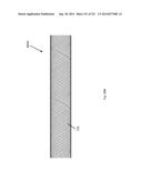 WOVEN VASCULAR DEVICE END TREATMENTS diagram and image