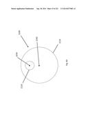 WOVEN VASCULAR DEVICE END TREATMENTS diagram and image