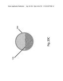 WOVEN VASCULAR DEVICE END TREATMENTS diagram and image