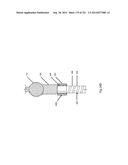 WOVEN VASCULAR DEVICE END TREATMENTS diagram and image