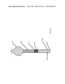 WOVEN VASCULAR DEVICE END TREATMENTS diagram and image