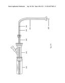 WOVEN VASCULAR DEVICE END TREATMENTS diagram and image