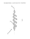 WOVEN VASCULAR DEVICE END TREATMENTS diagram and image