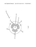 WOVEN VASCULAR DEVICE END TREATMENTS diagram and image