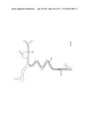 WOVEN VASCULAR DEVICE END TREATMENTS diagram and image