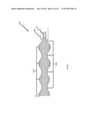 WOVEN VASCULAR DEVICE END TREATMENTS diagram and image