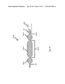 WOVEN VASCULAR DEVICE END TREATMENTS diagram and image