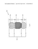 WOVEN VASCULAR DEVICE END TREATMENTS diagram and image