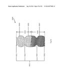 WOVEN VASCULAR DEVICE END TREATMENTS diagram and image