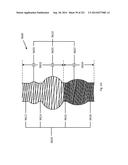 WOVEN VASCULAR DEVICE END TREATMENTS diagram and image