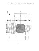 WOVEN VASCULAR DEVICE END TREATMENTS diagram and image