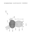 WOVEN VASCULAR DEVICE END TREATMENTS diagram and image