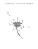 WOVEN VASCULAR DEVICE END TREATMENTS diagram and image