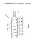 WOVEN VASCULAR DEVICE END TREATMENTS diagram and image