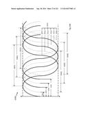 WOVEN VASCULAR DEVICE END TREATMENTS diagram and image