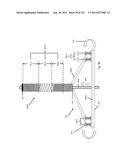 WOVEN VASCULAR DEVICE END TREATMENTS diagram and image