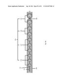 WOVEN VASCULAR DEVICE END TREATMENTS diagram and image