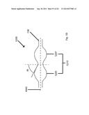 WOVEN VASCULAR DEVICE END TREATMENTS diagram and image