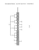 WOVEN VASCULAR DEVICE END TREATMENTS diagram and image