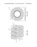 IMPLANTS, METHODS OF MANUFACTURING THE SAME, AND DEVICES AND METHODS FOR     DELIVERING THE IMPLANTS TO A VASCULAR DISORDER OF A PATIENT diagram and image