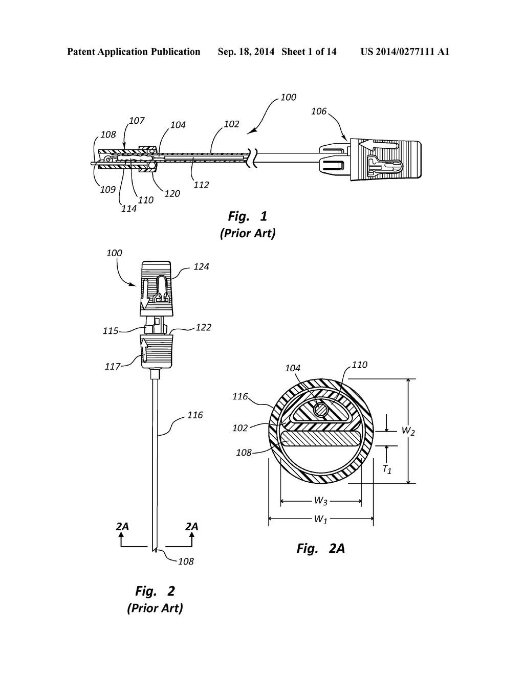 OVAL VASCULAR CLOSURE DEVICE AND METHODS - diagram, schematic, and image 02