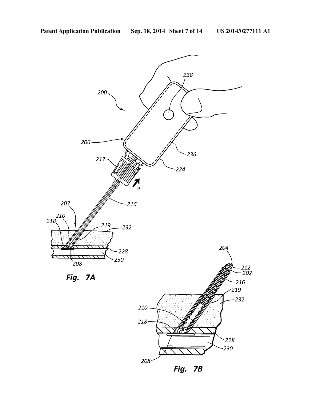 OVAL VASCULAR CLOSURE DEVICE AND METHODS - diagram, schematic, and image 08