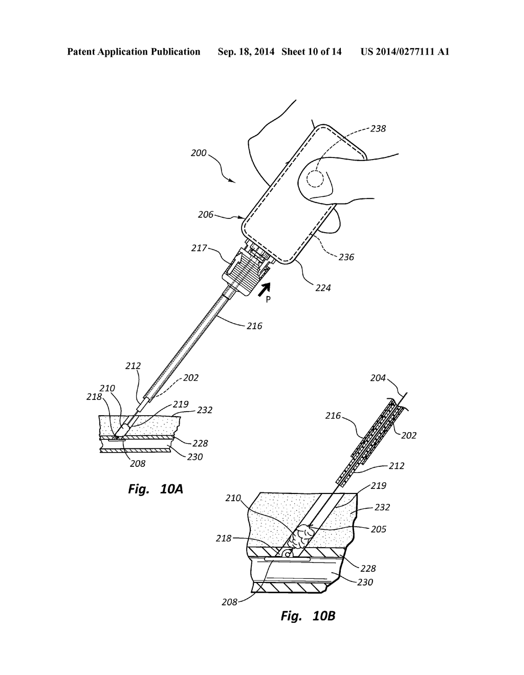 OVAL VASCULAR CLOSURE DEVICE AND METHODS - diagram, schematic, and image 11