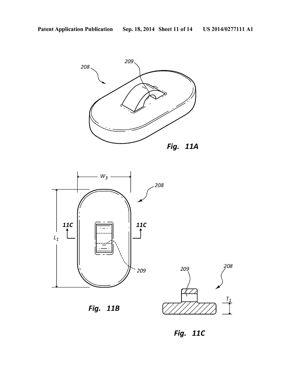 OVAL VASCULAR CLOSURE DEVICE AND METHODS - diagram, schematic, and image 12