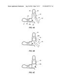 MEDICAL DEVICE FOR MODIFICATION OF LEFT ATRIAL APPENDAGE AND RELATED     SYSTEMS AND METHODS diagram and image