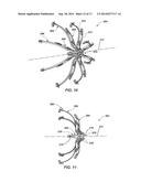 MEDICAL DEVICE FOR MODIFICATION OF LEFT ATRIAL APPENDAGE AND RELATED     SYSTEMS AND METHODS diagram and image