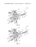 MEDICAL DEVICE FOR MODIFICATION OF LEFT ATRIAL APPENDAGE AND RELATED     SYSTEMS AND METHODS diagram and image